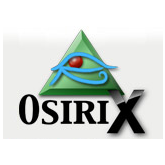 OsiriX MD 14.1/オザイリクス