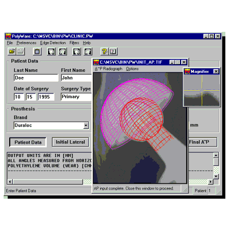 Программу efilm workstations